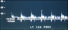 LICA sensit doppler-9